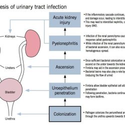 Urinary tract slideshare dealing infection symptoms upcoming